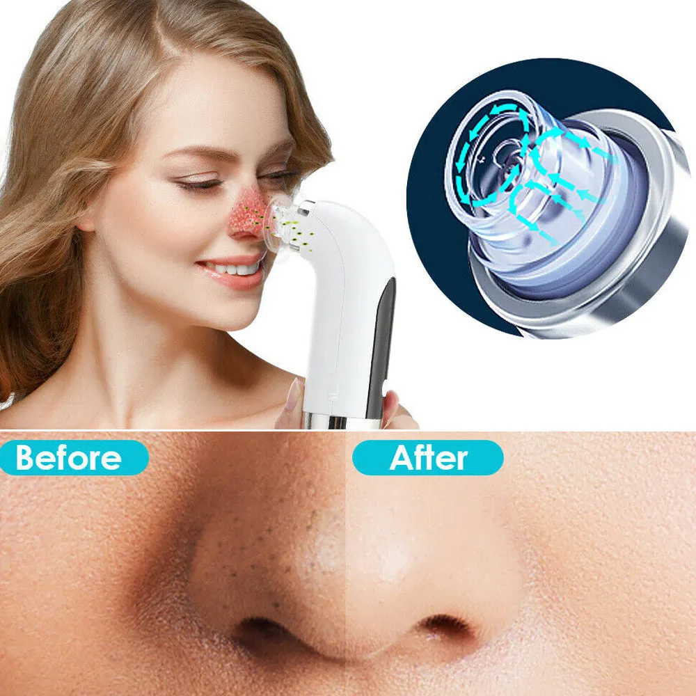 USB Rechargeable Electric Pore Blackhead Vacuum Cleaner